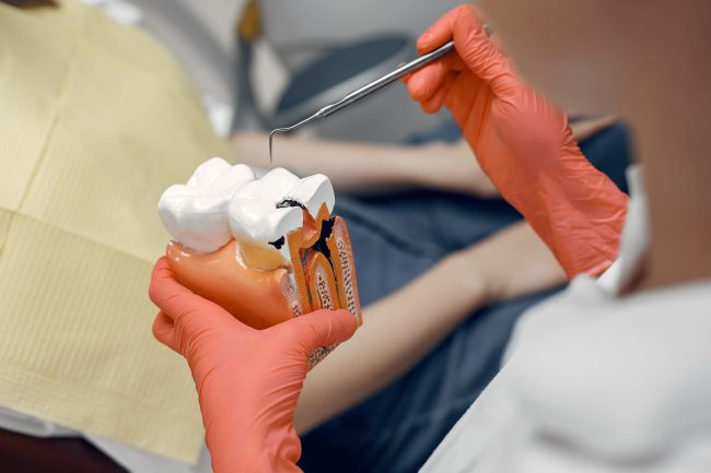 tratamiento de endodoncia en sevilla