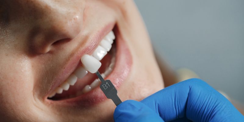 estética dental y autoestima