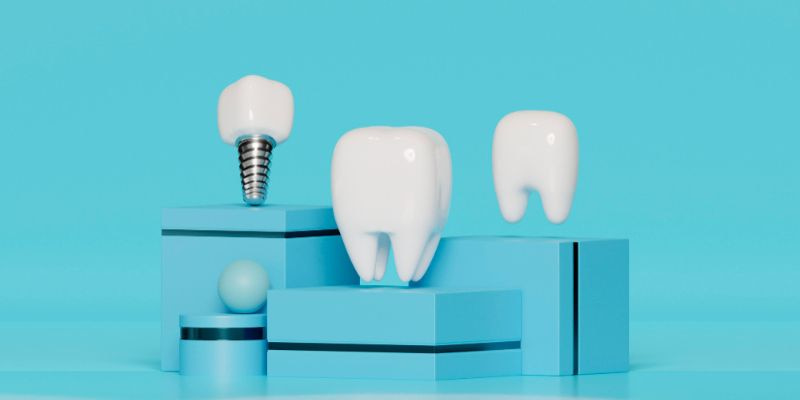 implante-dental