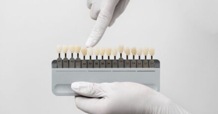 carillas-composite-vs-porcelana